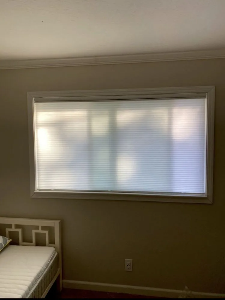 Slide of Nar Technique