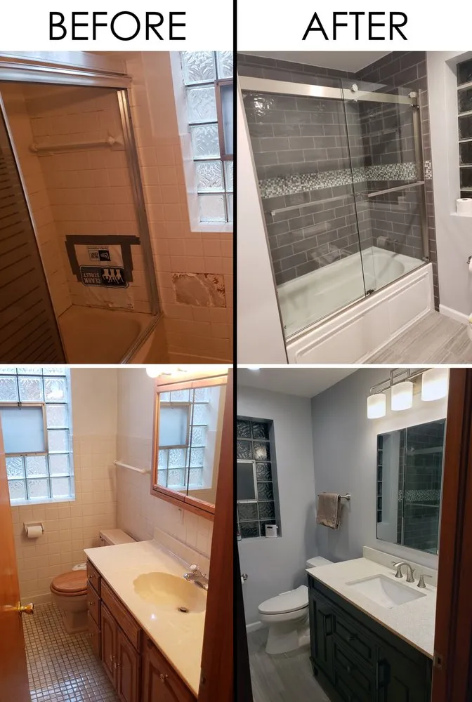 Slide of PLM Superior Remodeling