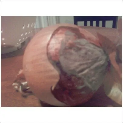 Slide of Prosser Services